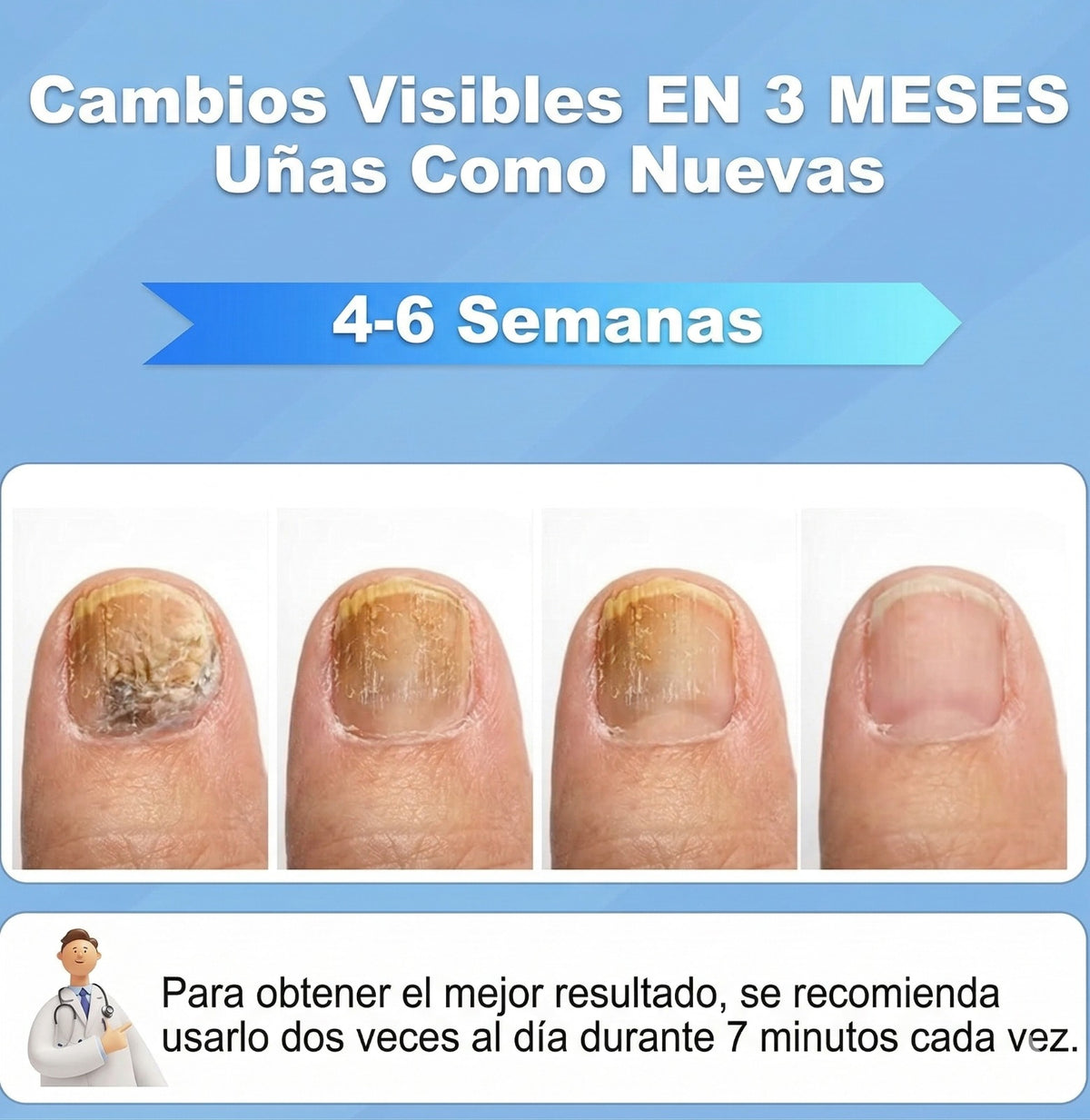 Lámpara UV Antihongos – Tratamiento para Uñas – Ayuda a Combatir Hongos en Casa
